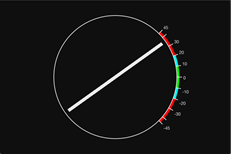 Motion artefact detection